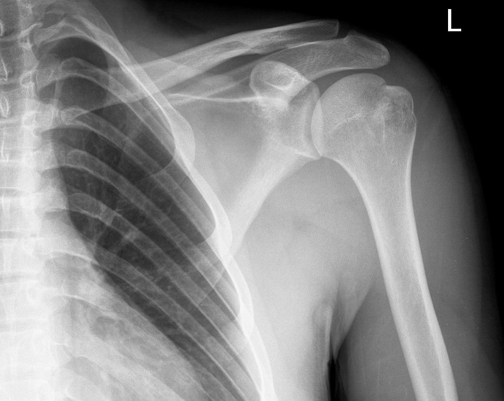 Film Radiographique Film Radiographique Primax au meilleur prix! • DISPOMA