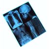 Film radiographique maroc