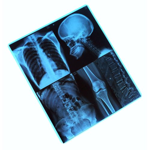 Film radiographique maroc