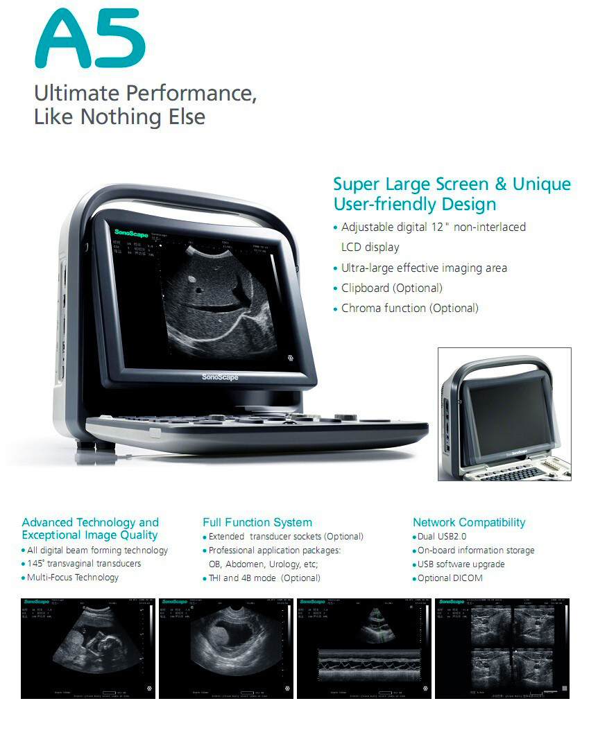 Echographe portable sonoscape maroc